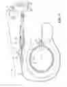 Fig. 03 - Cryoadhesive device for left atrial appendage occlusion