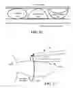 Fig. 12 - Cryoadhesive device for left atrial appendage occlusion