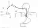 Fig. 01 - Cryogenic balloon ablation instruments and systems