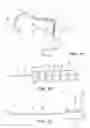 Fig. 02 - Cryogenic balloon ablation instruments and systems