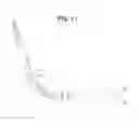 Fig. 18 - Surgical device with powered articulation wrist rotation