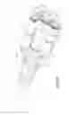 Fig. 21 - Surgical device with powered articulation wrist rotation