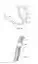 Fig. 05 - Multi-electrode catheter assemblies for renal neuromodulation and associated systems and methods