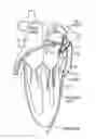 Fig. 01 - Methods and systems for accessing a pericardial space and preventing strokes arising from the left atrial appendage