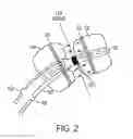 Fig. 03 - Methods and systems for accessing a pericardial space and preventing strokes arising from the left atrial appendage