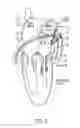 Fig. 07 - Methods and systems for accessing a pericardial space and preventing strokes arising from the left atrial appendage