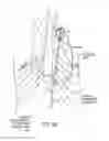 Fig. 11 - Methods and systems for accessing a pericardial space and preventing strokes arising from the left atrial appendage