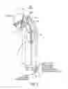 Fig. 12 - Methods and systems for accessing a pericardial space and preventing strokes arising from the left atrial appendage