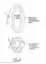 Fig. 13 - Methods and systems for accessing a pericardial space and preventing strokes arising from the left atrial appendage