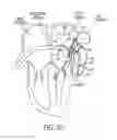 Fig. 23 - Methods and systems for accessing a pericardial space and preventing strokes arising from the left atrial appendage