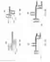 Fig. 09 - Methods and apparatuses for remodeling tissue of or adjacent to a body passage