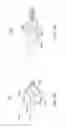 Fig. 12 - Methods and apparatuses for remodeling tissue of or adjacent to a body passage