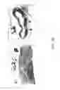Fig. 49 - Methods and apparatuses for remodeling tissue of or adjacent to a body passage