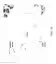 Fig. 52 - Methods and apparatuses for remodeling tissue of or adjacent to a body passage