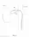 Fig. 57 - Methods and apparatuses for remodeling tissue of or adjacent to a body passage