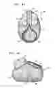 Fig. 06 - No-contact cover for stethoscopes and other devices