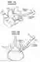 Fig. 02 - Proximal-end securement of a minimally invasive working channel