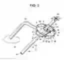 Fig. 04 - Proximal-end securement of a minimally invasive working channel