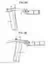 Fig. 11 - Proximal-end securement of a minimally invasive working channel