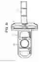 Fig. 14 - Proximal-end securement of a minimally invasive working channel
