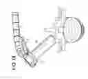 Fig. 17 - Proximal-end securement of a minimally invasive working channel