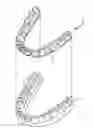 Fig. 01 - Class II malocclusion correction appliance for removable aligners