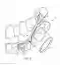 Fig. 03 - Class II malocclusion correction appliance for removable aligners