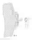 Fig. 05 - Class II malocclusion correction appliance for removable aligners