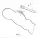 Fig. 08 - Class II malocclusion correction appliance for removable aligners