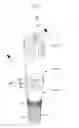 Fig. 02 - Fixture remover for implant