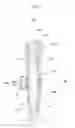 Fig. 03 - Fixture remover for implant