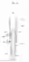 Fig. 20 - Fixture remover for implant