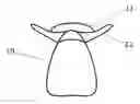 Fig. 01 - Replacement tooth with semi-rigid retention bar and method of manufacture