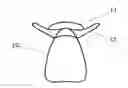 Fig. 02 - Replacement tooth with semi-rigid retention bar and method of manufacture