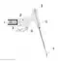 Fig. 02 - DEVICE FOR ENDODONTICS BY MEANS OF CONTINUOUS ULTRASONIC IRRIGATION
