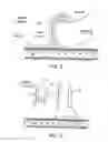 Fig. 03 - Fecal Incontinence Device, System And Method