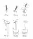 Fig. 04 - Fecal Incontinence Device, System And Method
