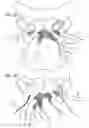 Fig. 09 - Implants and procedures for treatment of pelvic floor disorders