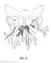 Fig. 10 - Implants and procedures for treatment of pelvic floor disorders