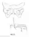Fig. 15 - Implants and procedures for treatment of pelvic floor disorders