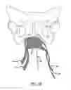 Fig. 17 - Implants and procedures for treatment of pelvic floor disorders