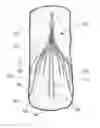 Fig. 01 - Visual stabilizer on anchor legs of vena cava filter