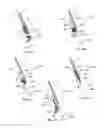 Fig. 05 - Visual stabilizer on anchor legs of vena cava filter