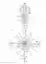 Fig. 06 - Visual stabilizer on anchor legs of vena cava filter