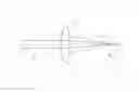Fig. 01 - ASPHERICAL INTRAOCULAR LENS