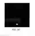 Fig. 08 - Intraocular Lens With Central Hole For Improved Fluid Flow And Minimized Light Scattering