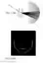 Fig. 12 - Intraocular Lens With Central Hole For Improved Fluid Flow And Minimized Light Scattering