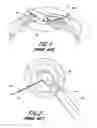 Fig. 02 - Intraocular lens inserter