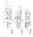 Fig. 06 - Intraocular lens inserter