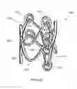 Fig. 17 - Prosthetic heart valve